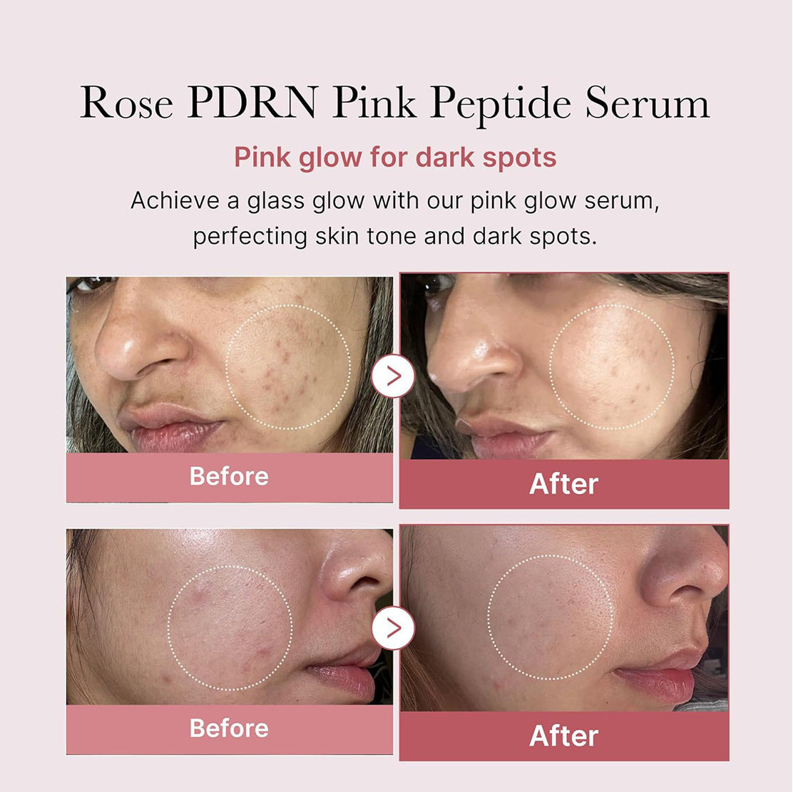 PDRN Post-Needling Collagen Serum (30ml)