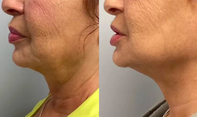 The Wrinkle Retreat 2.0™ Clinical Protocol: The Complete 4 Step Cortisol-Repair System