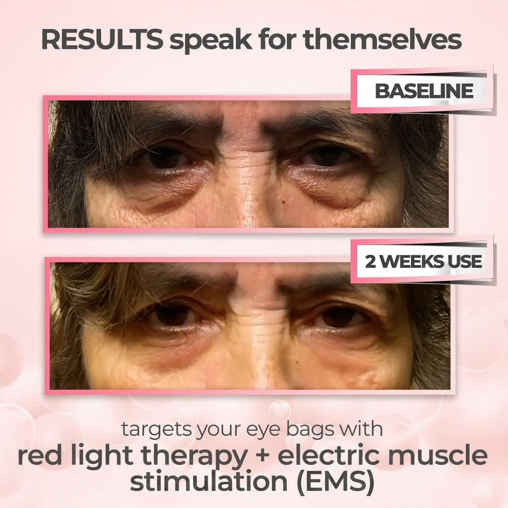 The Wrinkle Retreat 2.0™ Clinical Protocol: The Complete 4 Step Cortisol-Repair System