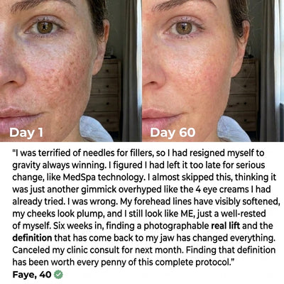 Solara Paris Red Light Therapy Mask