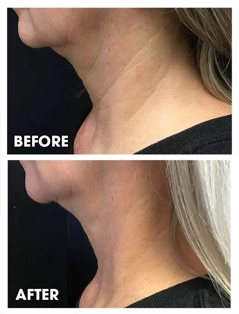 The Wrinkle Retreat 2.0™ Clinical Protocol: The Complete 4 Step Cortisol-Repair System