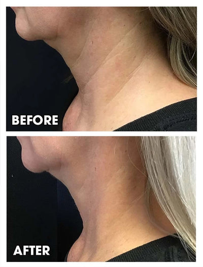The Wrinkle Retreat 2.0™ Clinical Protocol: The Complete 4 Step Cortisol-Repair System