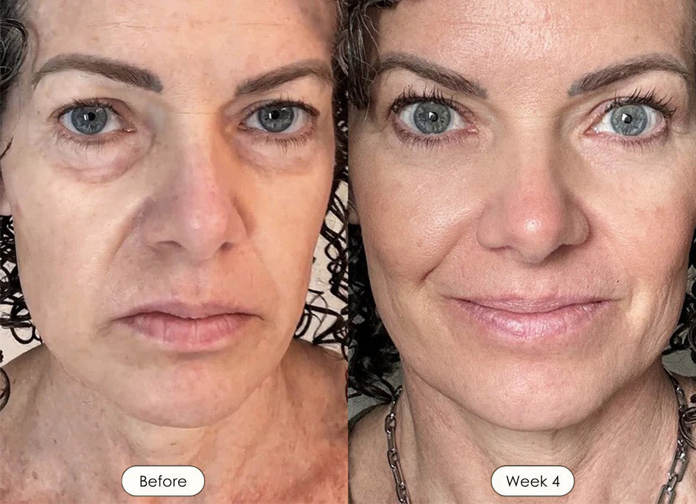 Wrinkle Retreat 2.0 LED Face Mask Only