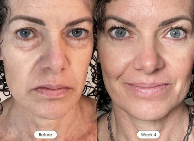 Wrinkle Retreat 2.0 LED Face Mask Only