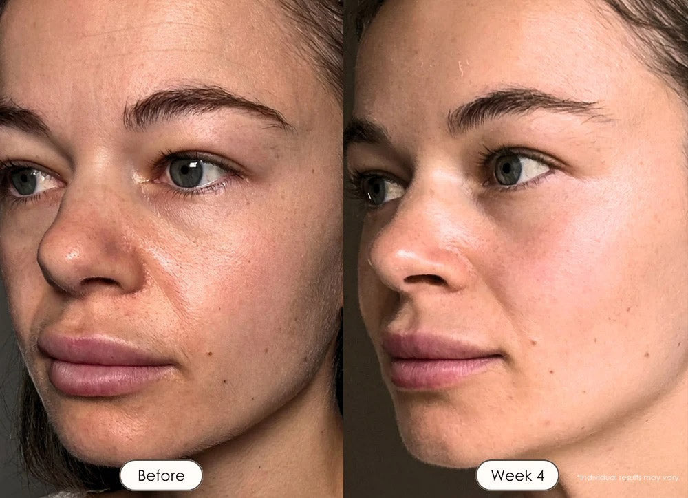 Wrinkle Retreat 2.0 LED Face Mask Only