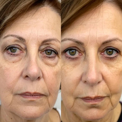 The Wrinkle Retreat 2.0™ Clinical Protocol: The Complete 4 Step Cortisol-Repair System