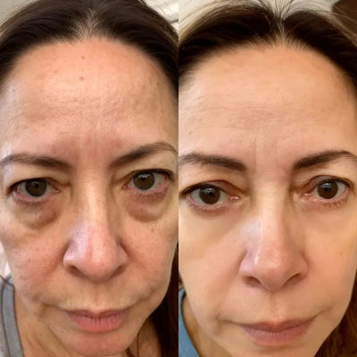 The Wrinkle Retreat 2.0™ Clinical Protocol: The Complete 4 Step Cortisol-Repair System