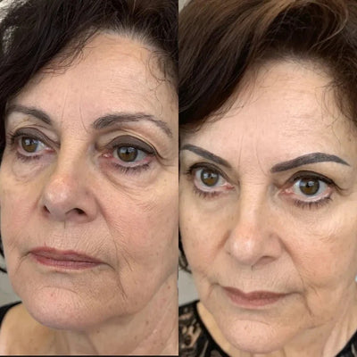 The Wrinkle Retreat 2.0™ Clinical Protocol: The Complete 4 Step Cortisol-Repair System