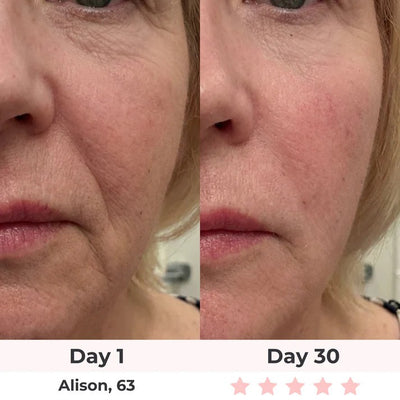 Solara Paris Red Light Therapy Mask