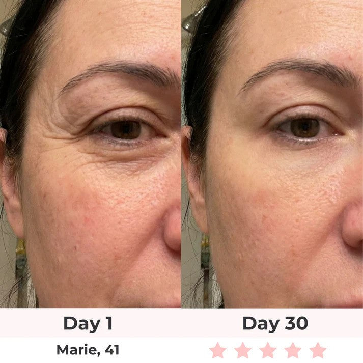 Solara Paris Red Light Therapy Mask