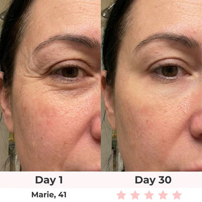 Solara Paris Red Light Therapy Mask