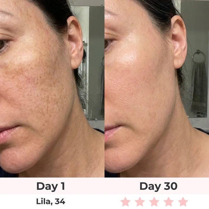 Solara Paris Red Light Therapy Mask