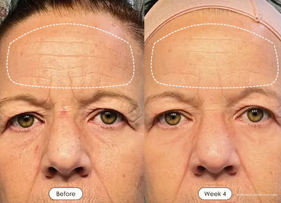 Wrinkle Retreat 2.0 LED Face Mask Only