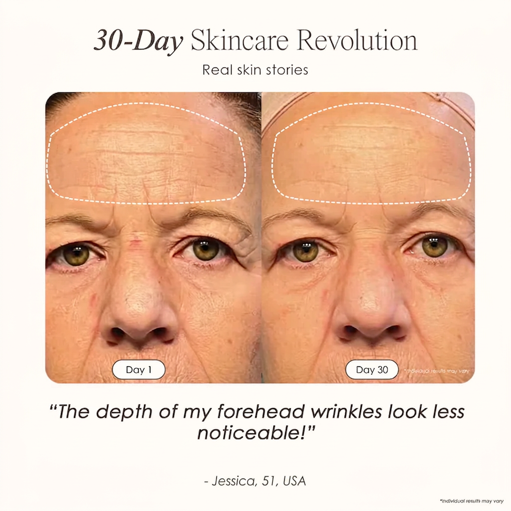 The Wrinkle Retreat 2.0™ Clinical Protocol: The Complete 4 Step Cortisol-Repair System