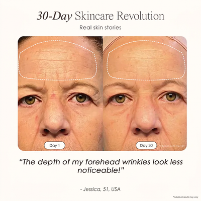 The Wrinkle Retreat 2.0™ Clinical Protocol: The Complete 4 Step Cortisol-Repair System