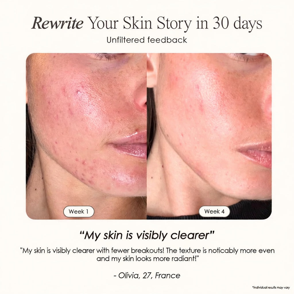 The Wrinkle Retreat 2.0™ Clinical Protocol: The Complete 4 Step Cortisol-Repair System