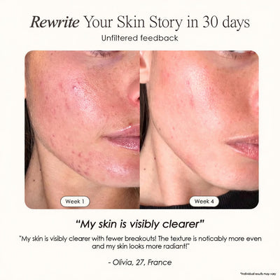 The Wrinkle Retreat 2.0™ Clinical Protocol: The Complete 4 Step Cortisol-Repair System