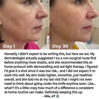 Solara Paris Red Light Therapy Mask